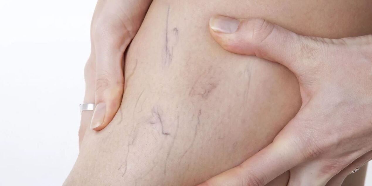 Před použitím varianového krému