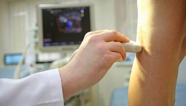 Laserová ošetření křečových žil