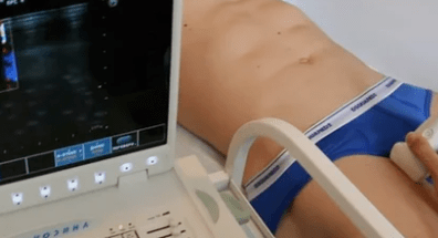 Diagnostické možnosti pro křečové žíly dolních končetin